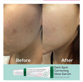 سرم ضد لک اکسیس وای مدل Dark Spot حجم 50 میلی لیتر