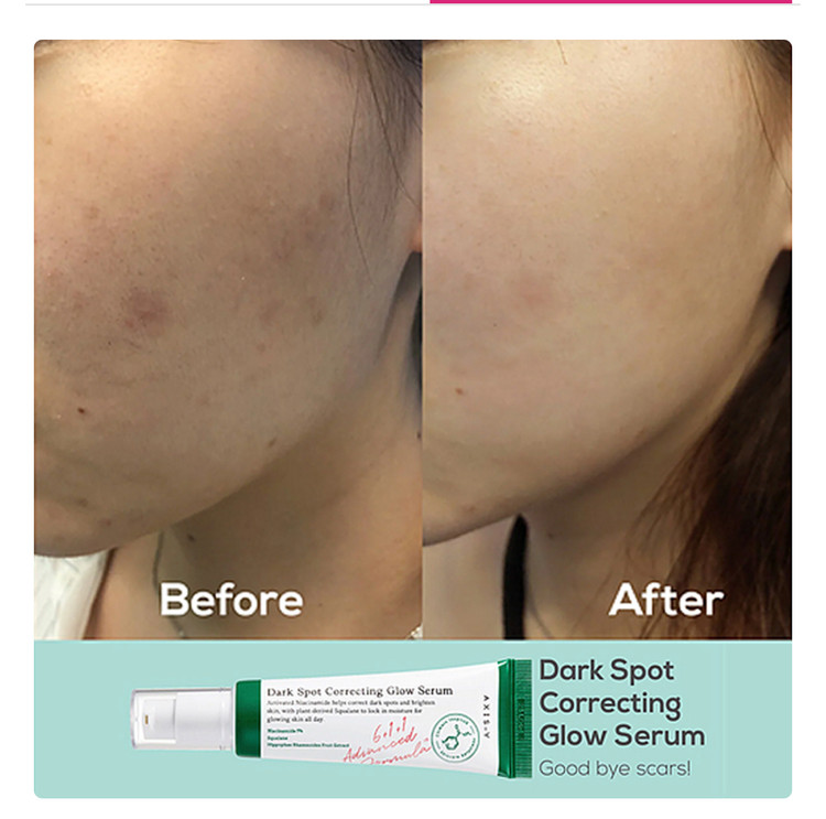 سرم ضد لک اکسیس وای مدل Dark Spot حجم 50 میلی لیتر